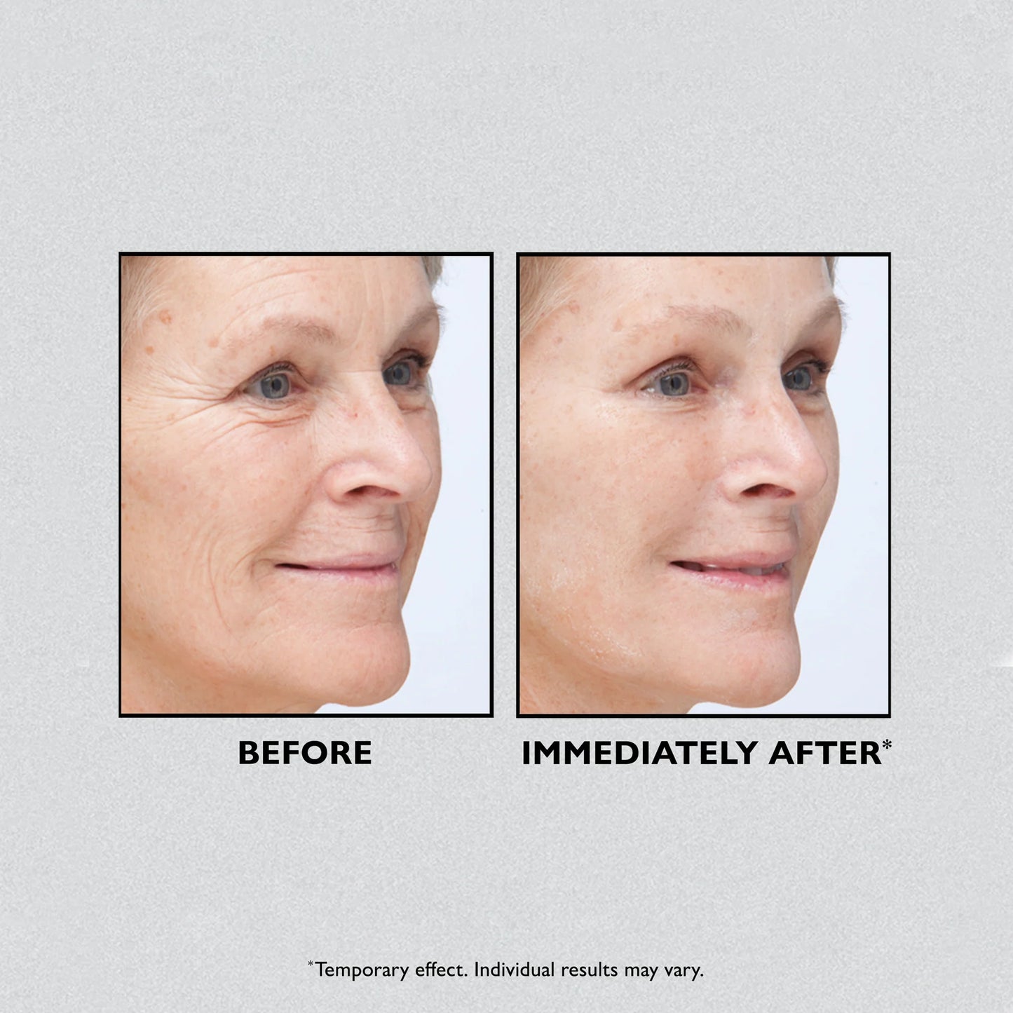 Temporary Face Tightener