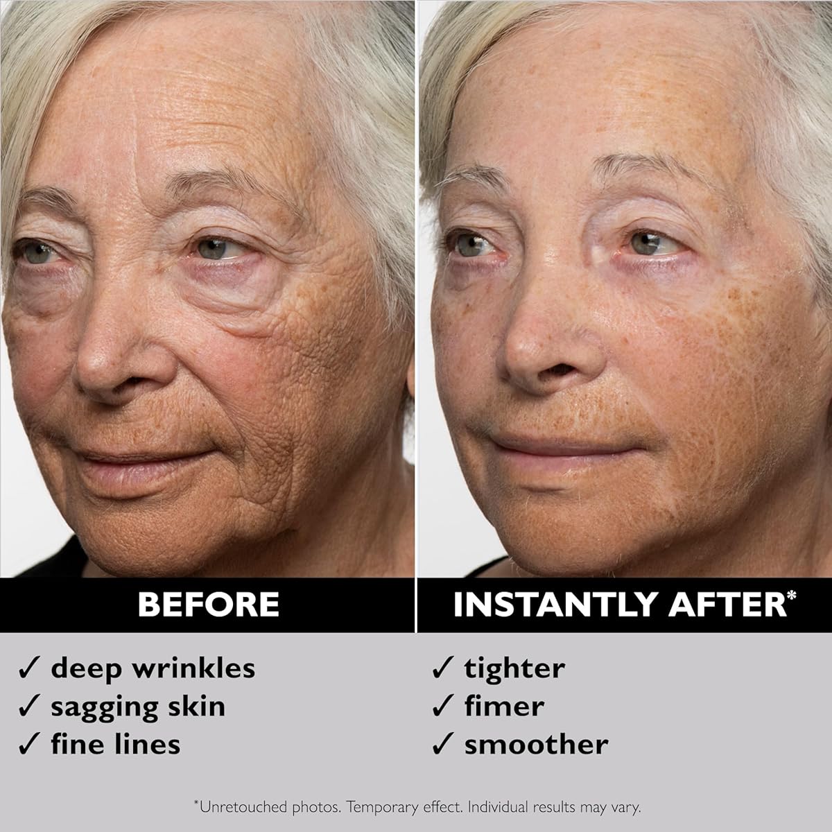 Temporary Face Tightener