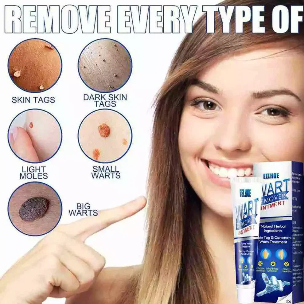 Wart Remover Cream – Fast & Effective
