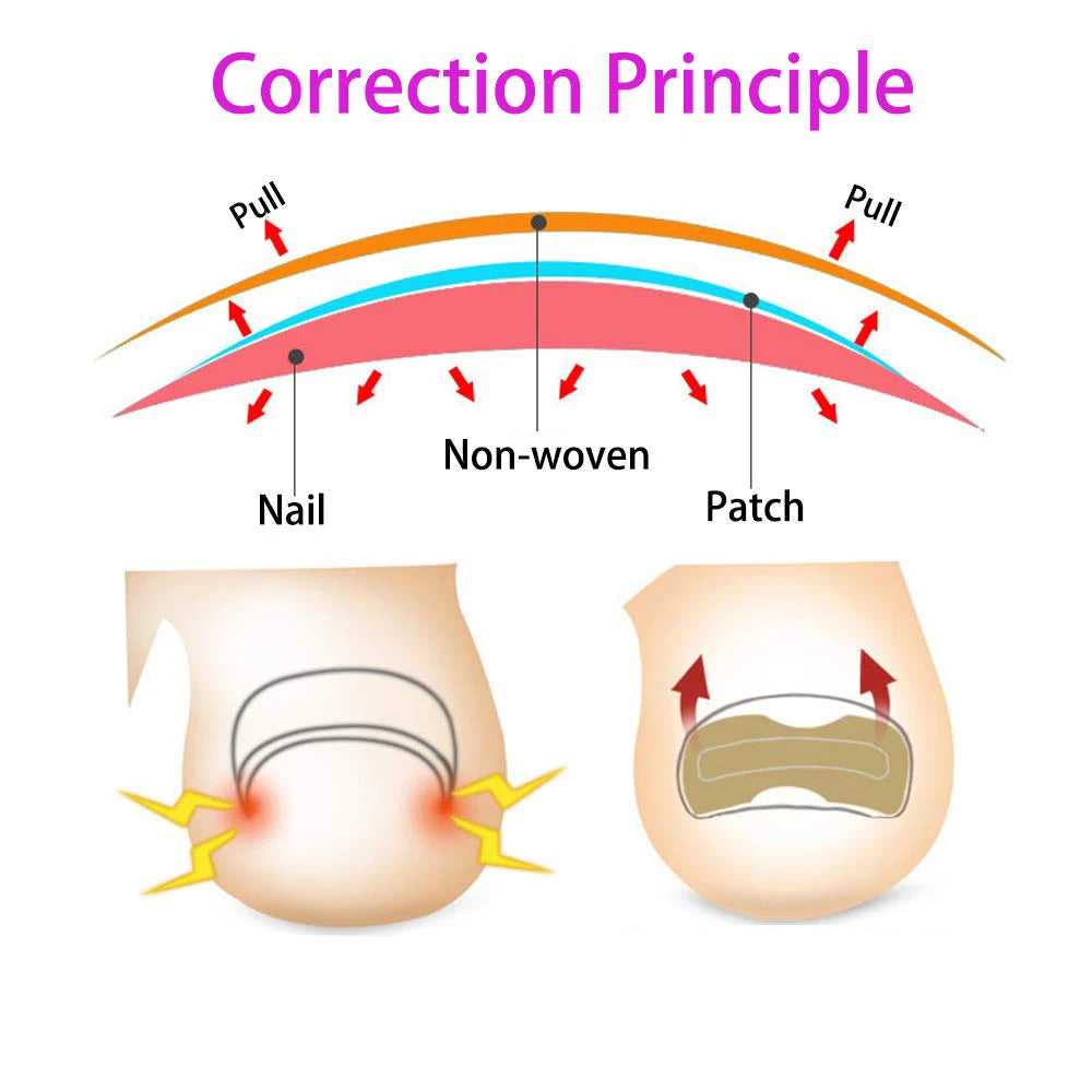 Correction patches for beautiful and healthy nails