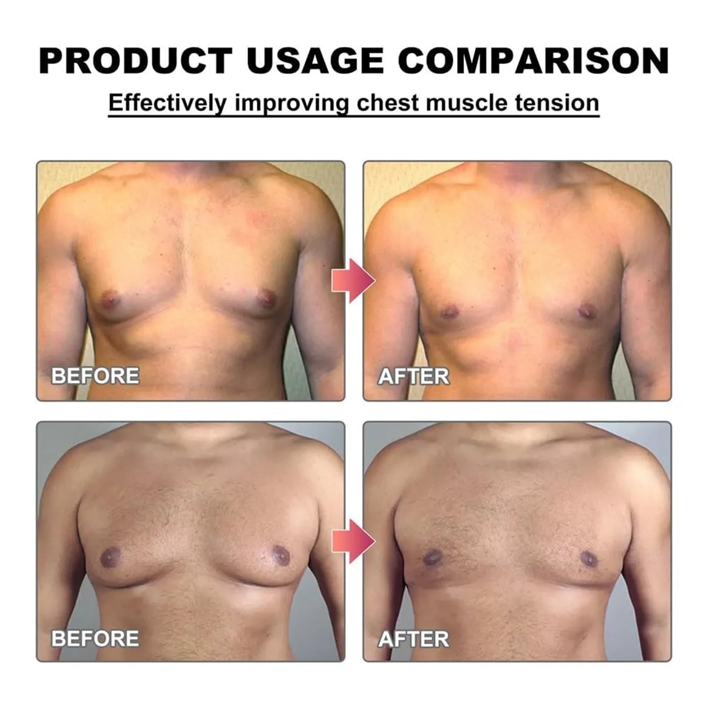 MenTherm Bee Venom Gynecomastia Heating Oil