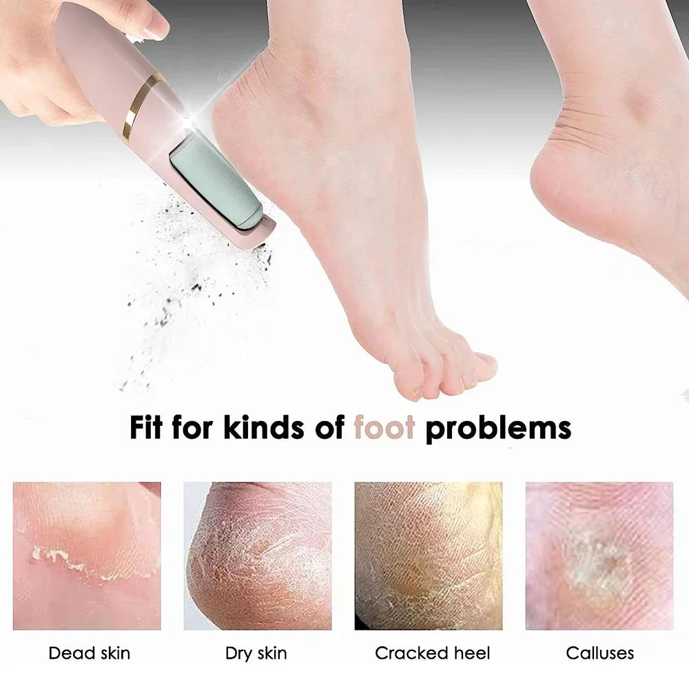 Electric Callus Remover for Feet