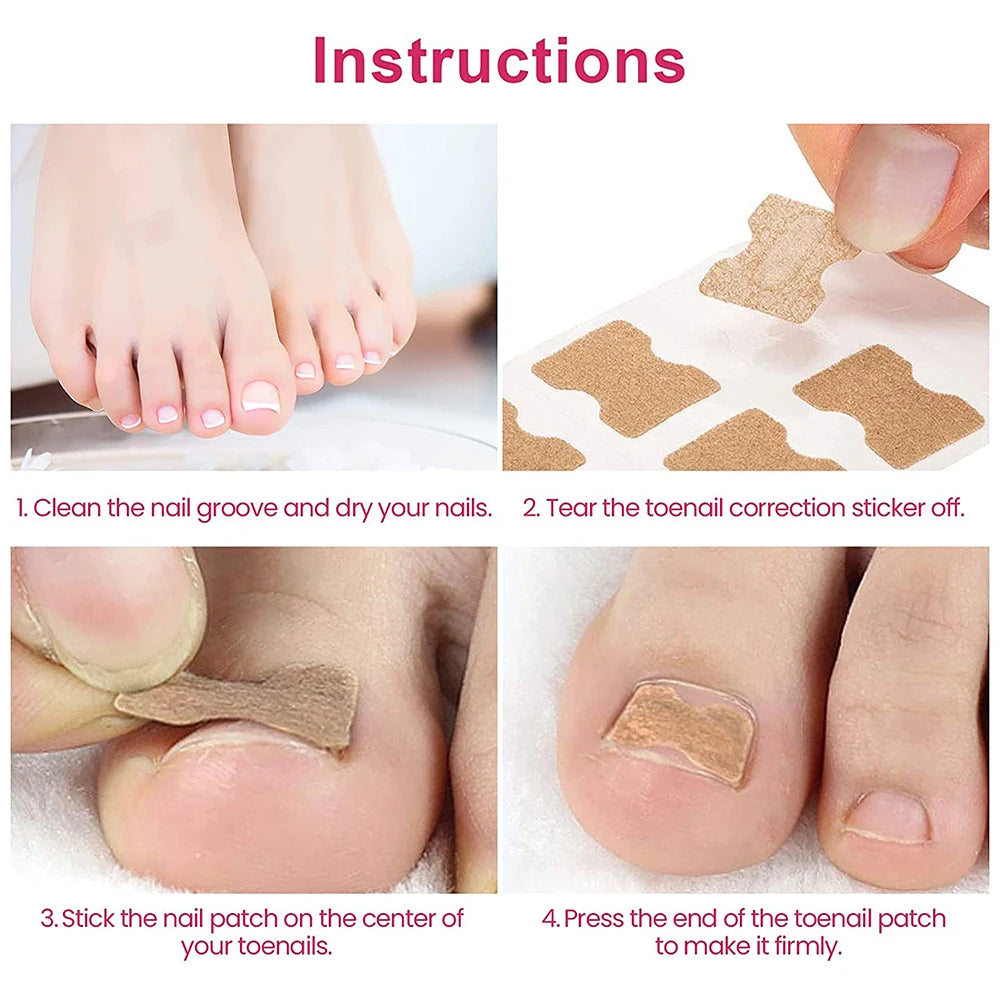 Correction patches for beautiful and healthy nails