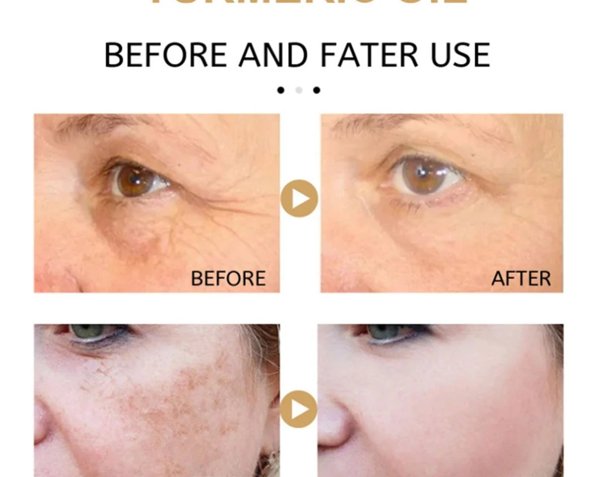 Turmeric Dark Spot Corrector Serum