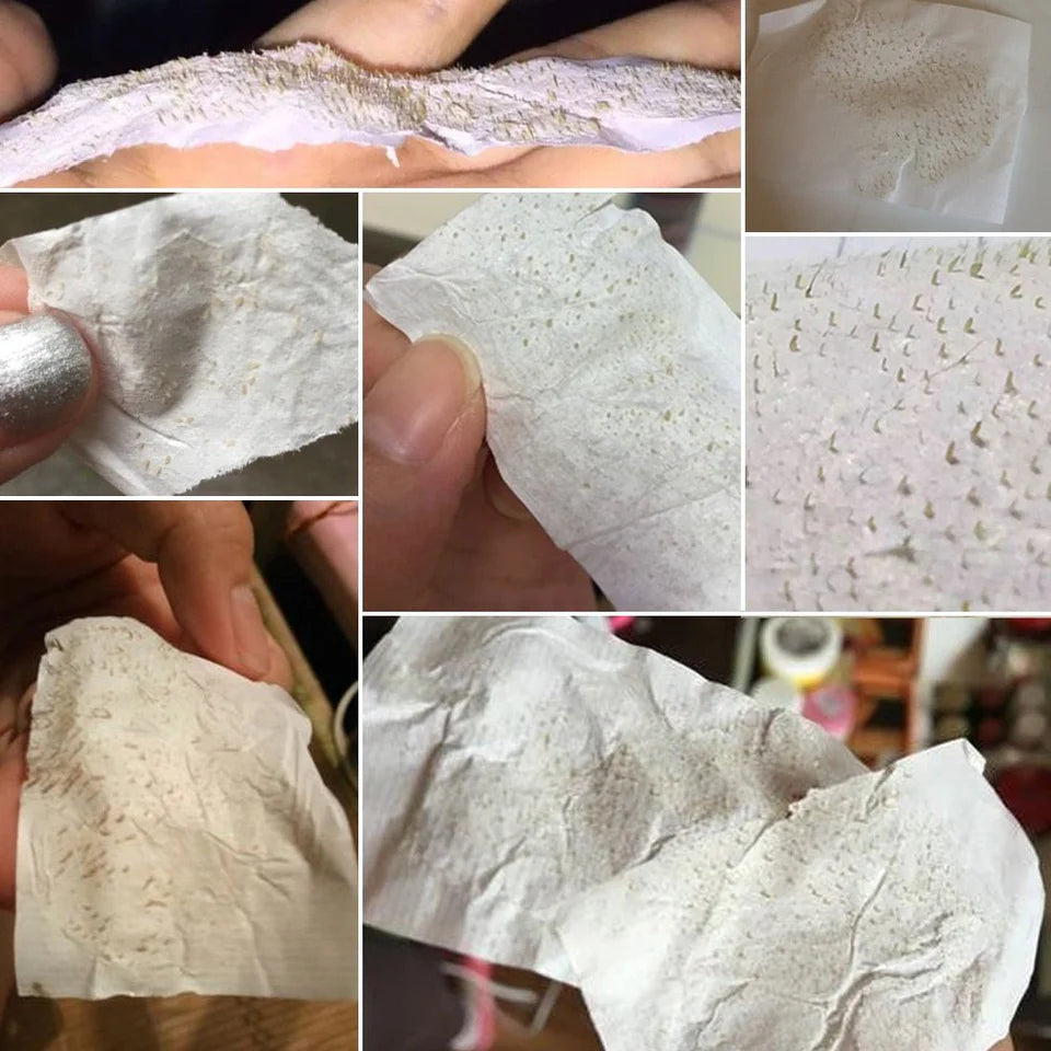 Blackhead Remover Mask
