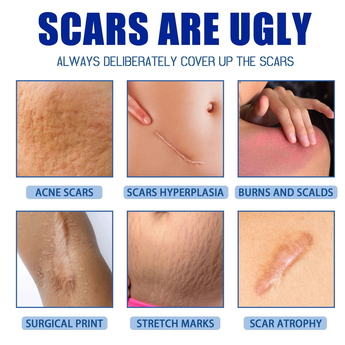 Scar & Mark Repair Cream
