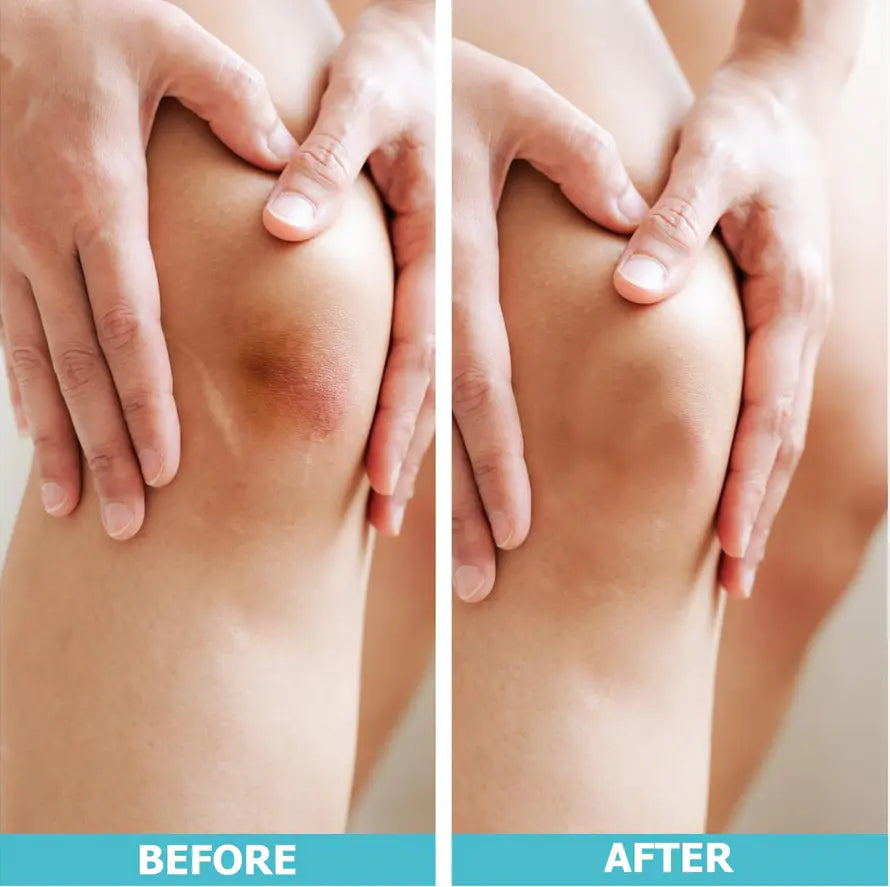 Hydrocolloid Healing Roll