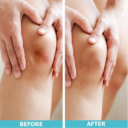 Hydrocolloid Healing Roll