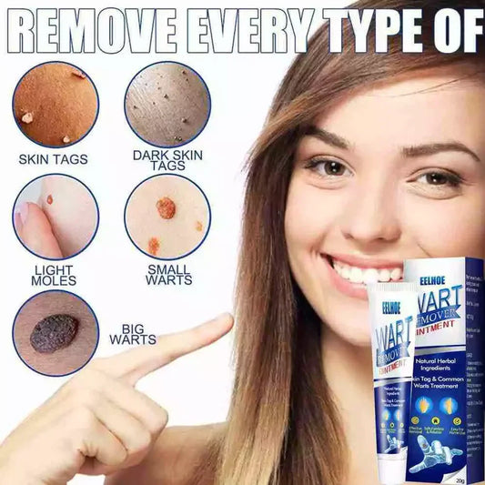 Wart Remover Cream – Fast & Effective