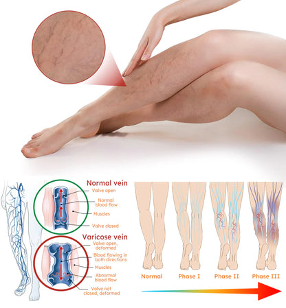 Turmeric Varicose Vein Patch