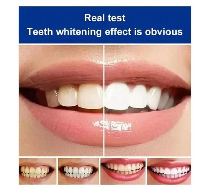 TheStorche ™ ToothPaste