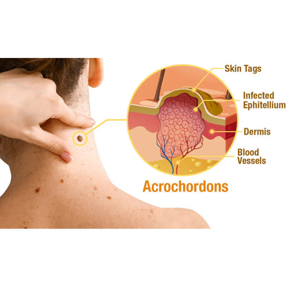 AQA™ TagRecede Bee Venom Spray