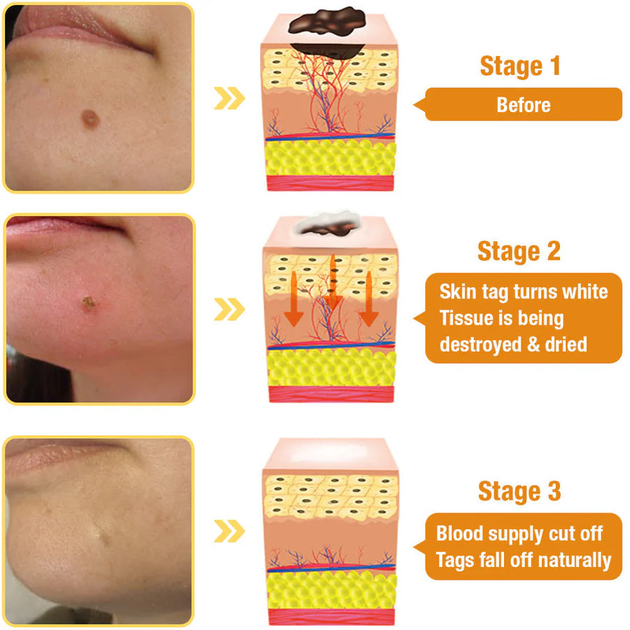 AQA™ TagRecede Bee Venom Spray
