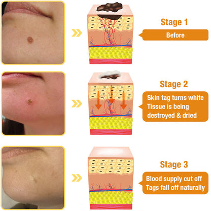 AQA™ TagRecede Bee Venom Spray