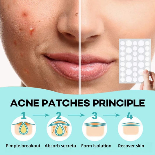 Pimple Patches