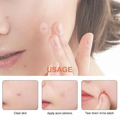 Pimple Patches