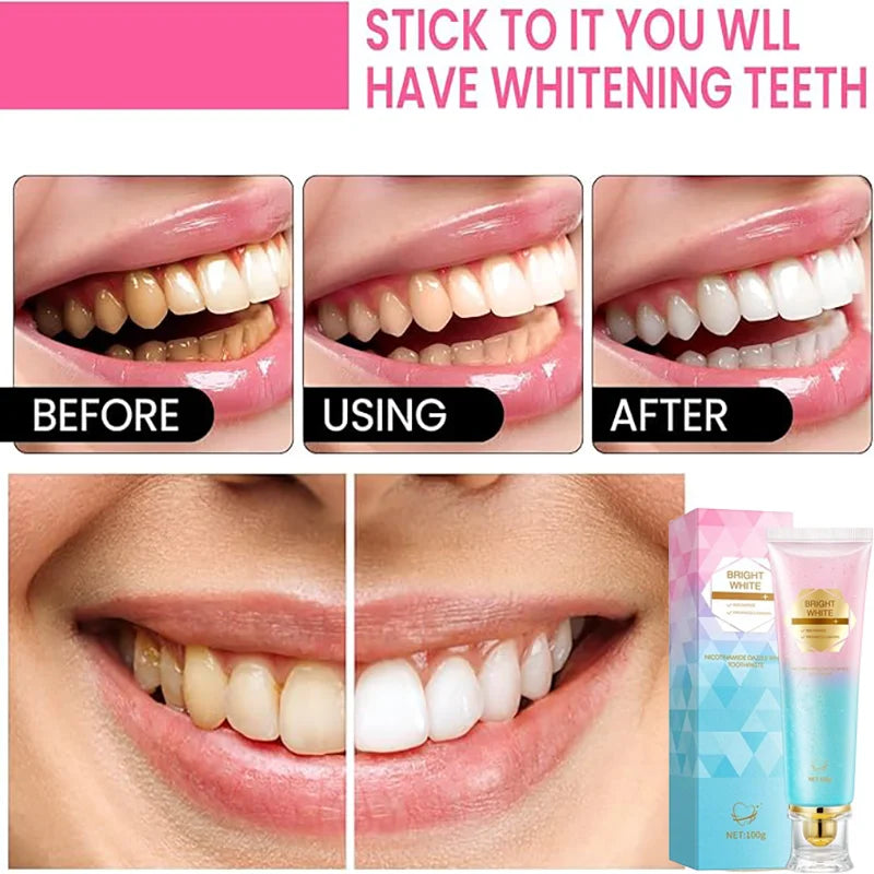 Niacinamide Whitening Toothpaste – The Storche