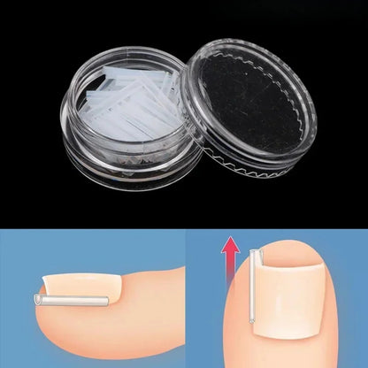 Toenail Relief Strips set