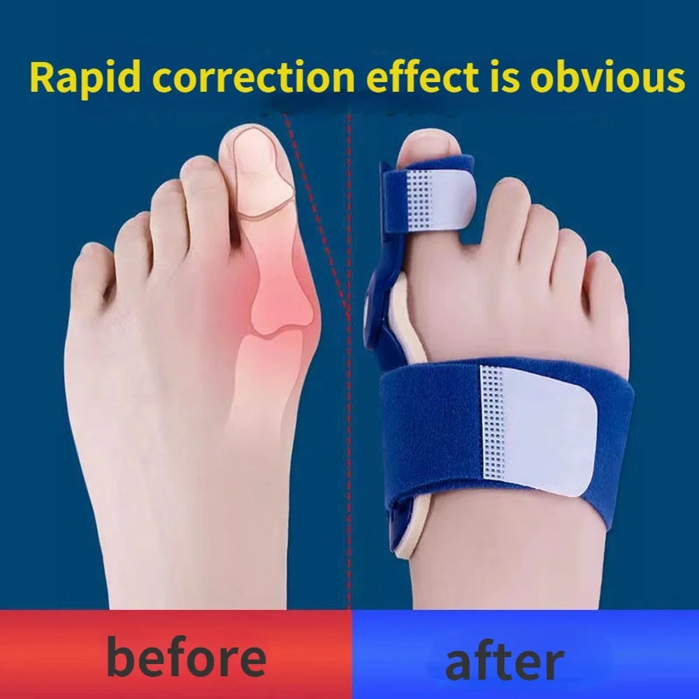 FlexFix™ Toe Splint