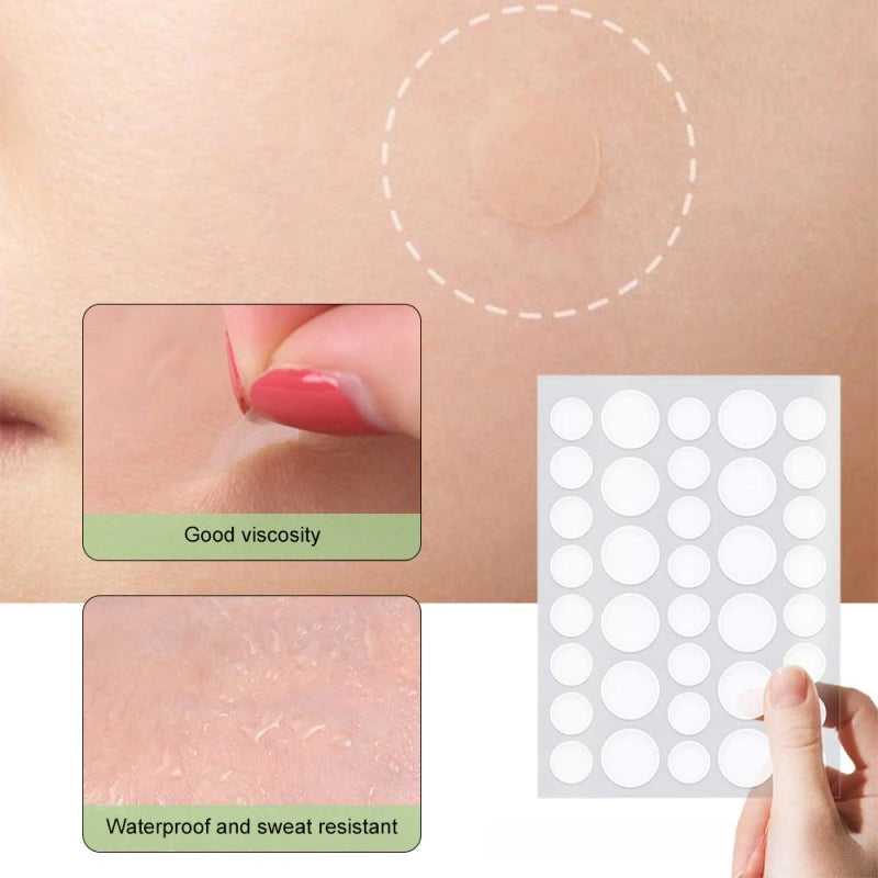 Pimple Patches