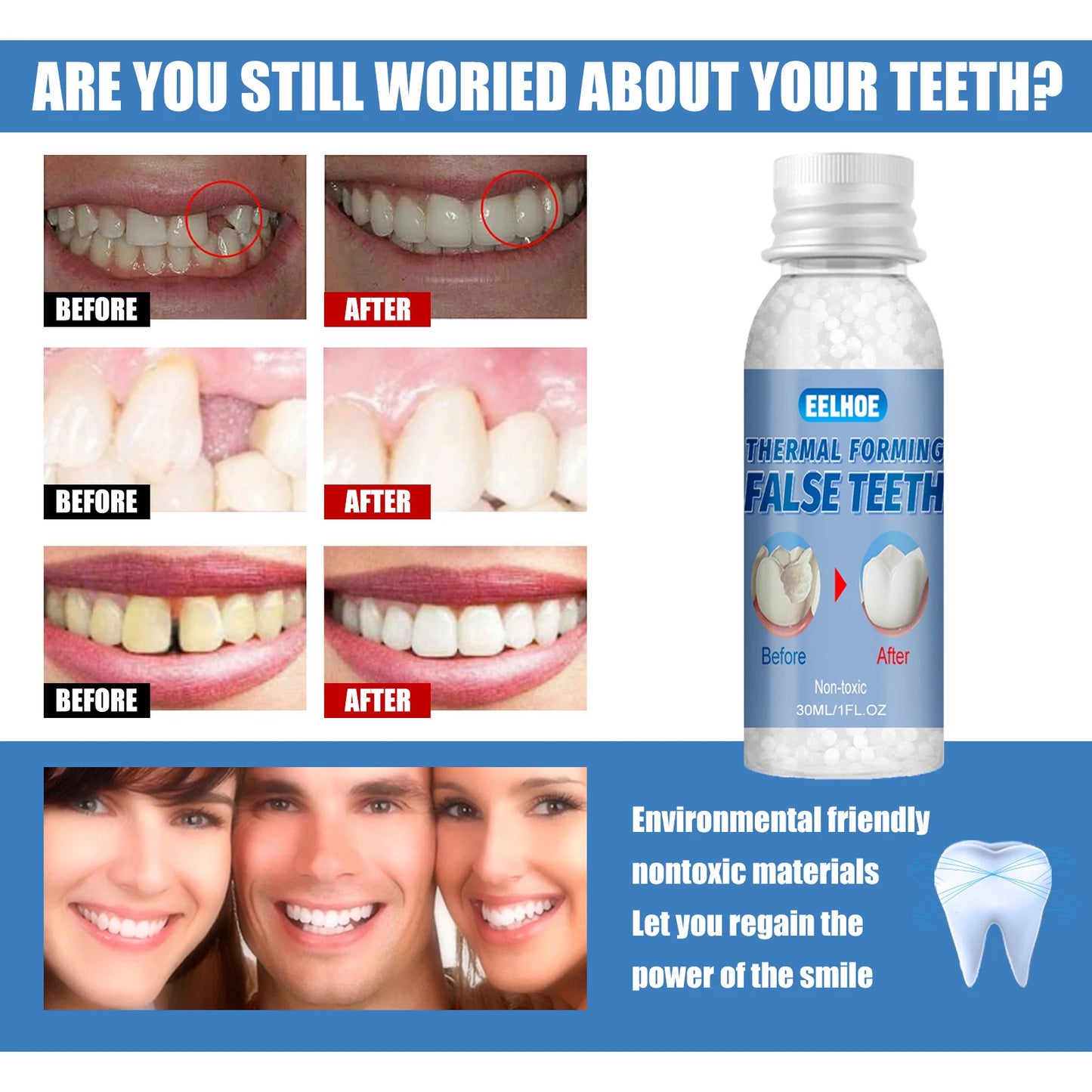 Temporary Teeth Repair kit