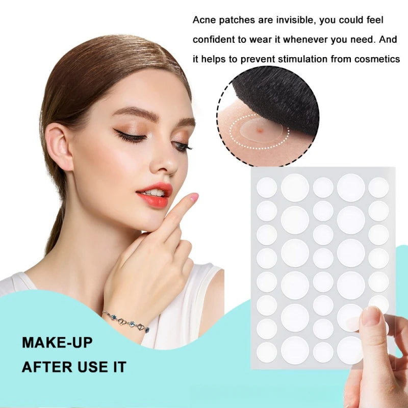 Pimple Patches