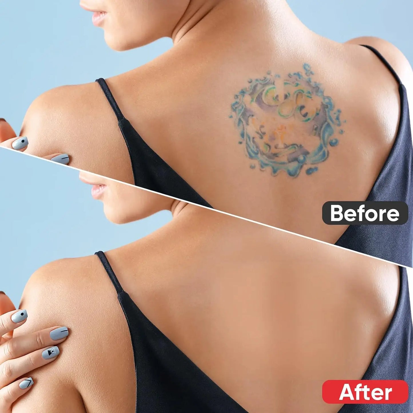 Tattoo and Scar Cover Up Patch