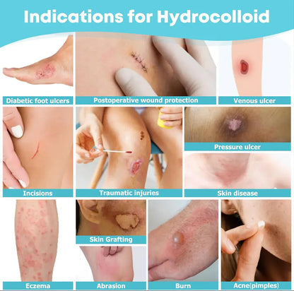 Hydrocolloid Healing Roll