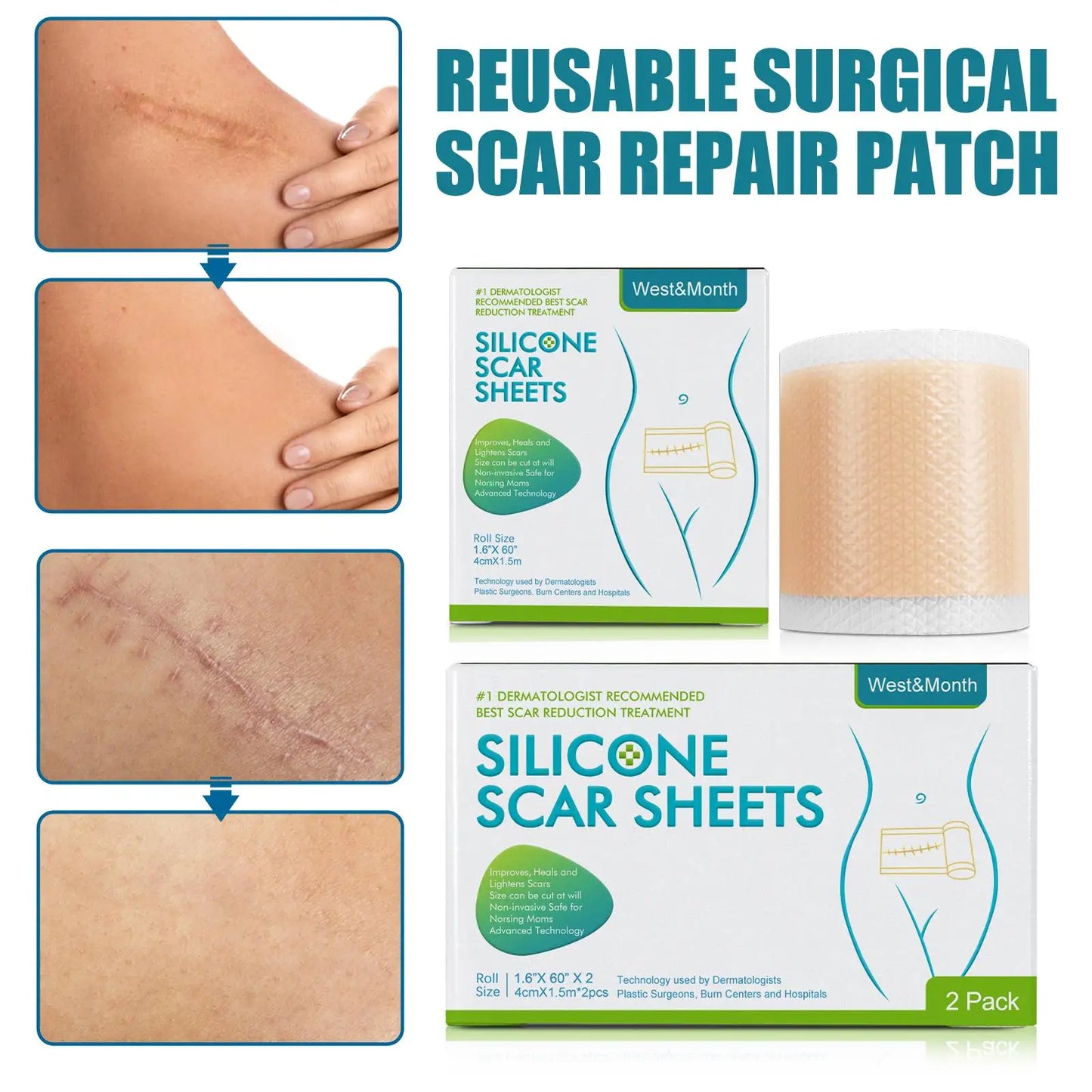 Silicon Scar Tape