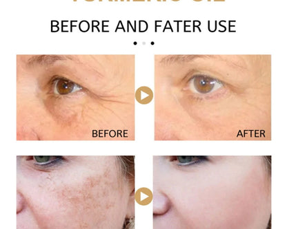 Turmeric Dark Spot Corrector Serum