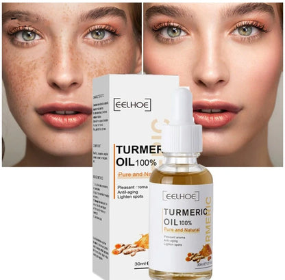 Turmeric Dark Spot Corrector Serum
