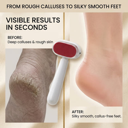 SmoothStep Foot Callus Remover