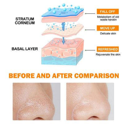 Orange Enzyme Exfoliating Gel